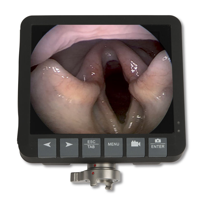 Monitor EickView